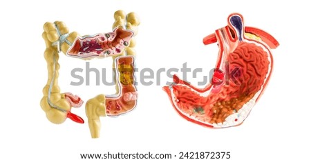 Intestine and stomach model isolated on white background, doctor holding anatomy model for study diagnosis and treatment in hospital. Royalty-Free Stock Photo #2421872375