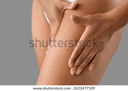 Beautiful young African-American woman with stretch marks on her body against grey, closeup