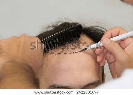 hair transplant man women fue dhi sapphire hair care Royalty-Free Stock Photo #2422881097