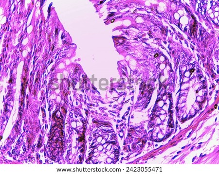 photo of amimal tissue slide under the microscope