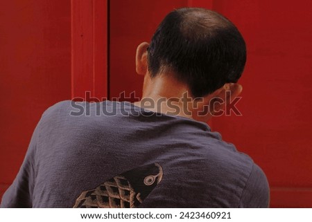 picture of hairfall in men