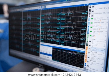 Modern medical computer technologies. Screen health monitoring equipment.