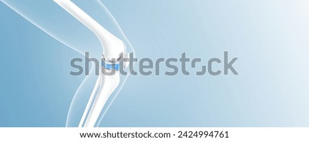 Total knee replacement or implant for treatment relieve arthritis, after joint damaged. Leg bone and cartilage side with copy space for text. Medical health care science technology concept. 3D vector. Royalty-Free Stock Photo #2424994761