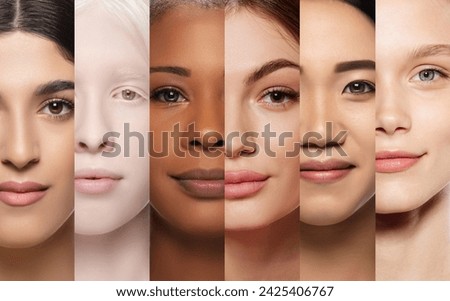 Medical and dermatological materials on skin conditions. Collage. Close-up of beautiful young girls of different nationality and skin colors. Concept of human diversity, beauty standards, cosmetics Royalty-Free Stock Photo #2425406767
