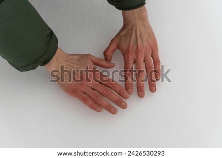 man's hands turning red in the snow, symbolizing resilience and strong immunity to winter. This image captures the determination of the human spirit in extreme cold.
