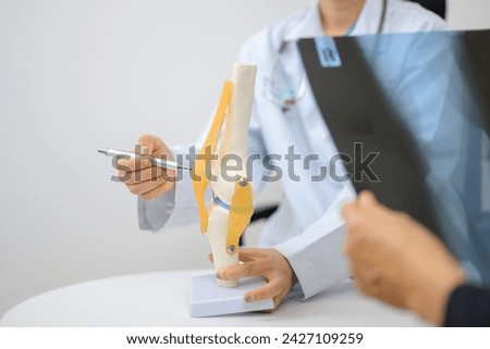 A female orthopedic surgeon shows knee bone model Explaining to a patient about the treatment of cruciate ligament injury in the knee medical treatment model.
