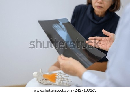 An orthopedic doctor holding an x-ray sheet of ankle and foot bones is explaining to a patient about foot bone problems. Concept of health care for feet and foot bones