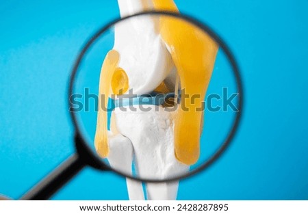 Medical mockup of a knee joint on a blue background under a magnifying glass. Knee joint problems concept. Bursitis, tendonitis and gout. Orthopedics Royalty-Free Stock Photo #2428287895