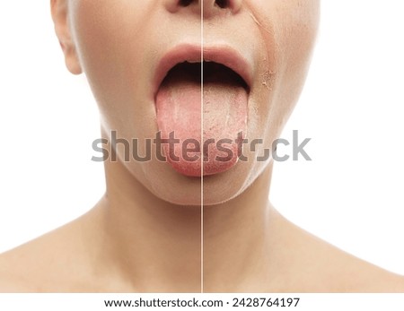 Dental health and hygiene. Half-face comparison with dry, peeling skin and tongue against white studio background. Collage. Concept of natural beauty, anti aging, cosmetology, female health. Ad