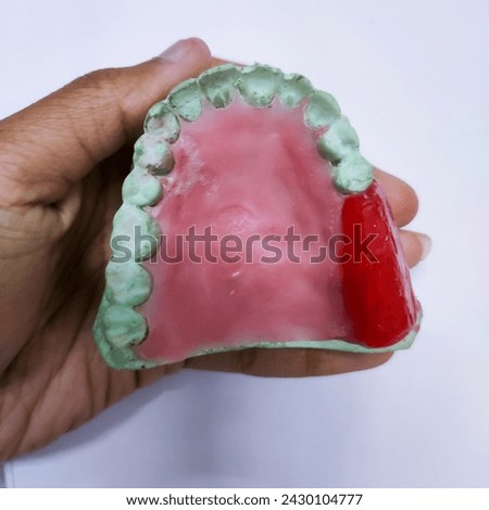 selective focus picture of cast denture of Kennedy's tooth arrangement for partial edentulism 