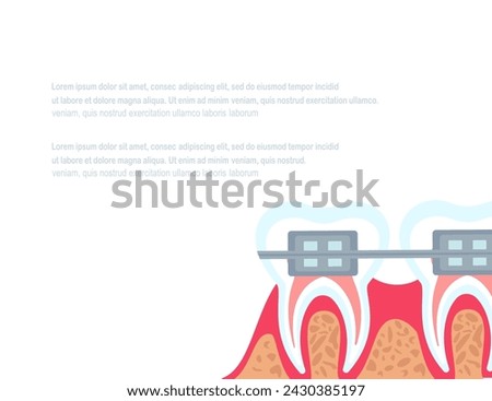 Dentistry Stomatology poster,White Background.Vector illustration.Dental Hygiene Concept Clinic Healthy Clean Teeth,Dental implants,Orthodontic Anchor.Dentist Tools,Equipment.Place for your text