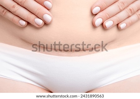Close up womans belly with scar after C section. 