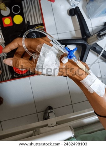 An IV tube attached to a patient's hand