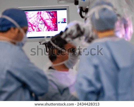 in neurosurgery surgery, neurosurgeons operate with microscopes with high imaging technology, O-arm navigation system in spine surgery. Stereotactic Imaging in Deep Brain Stimulation Surgery