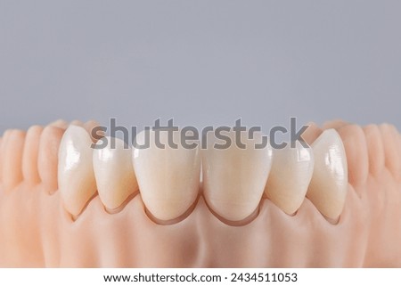 Six ceramic crowns on silicone gums. Dental model of teeth front view.  Royalty-Free Stock Photo #2434511053