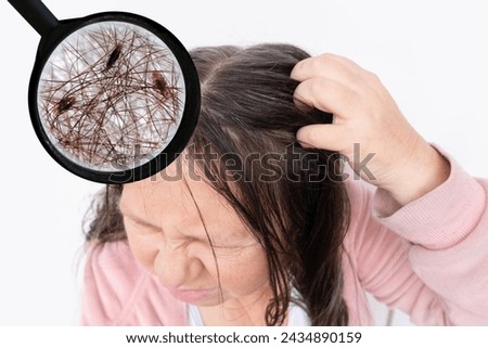 woman scratching head, close-up hair lice, feeling itchy and possibly having lice, showing effects of infestation, Medical conditions, Pediculosis, itching and irritation
