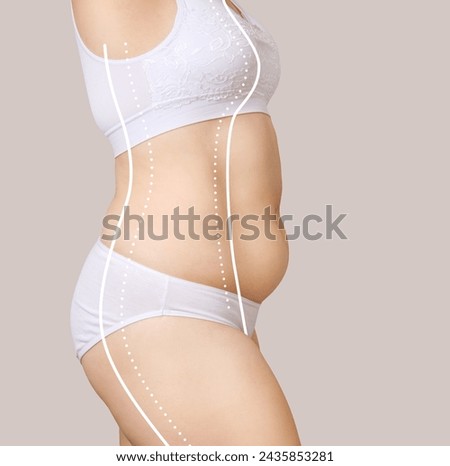 Woman with excess weight with silhouette of perfect body. Plastic surgery concept.