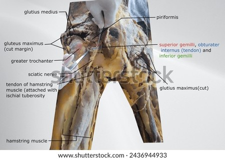 dissection of gluteal region with sciatic nerve passage Royalty-Free Stock Photo #2436944933