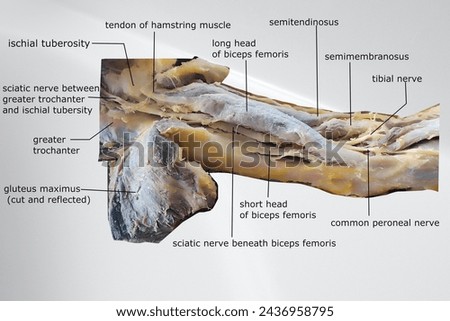 dissection image of the muscle of the back of the thigh with sciatic nerve and popliteal fossa  Royalty-Free Stock Photo #2436958795