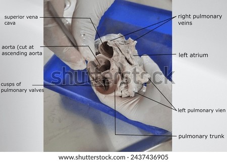 superior view of heart showing opening of aorta, pulmonary trunk and superior vena cava with related valves Royalty-Free Stock Photo #2437436905