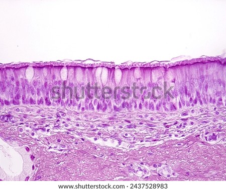 
Trachea. Ciliated pseudostratified columnar epithelium showing an apical layer of cilia (hair-like) anchored in their basal bodies. Among ciliated cells, some goblet cells can be seen. Royalty-Free Stock Photo #2437528983