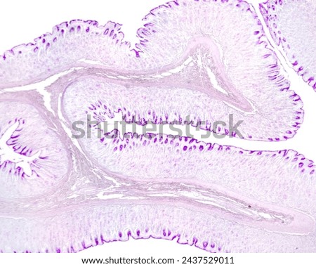 Gastric wall mucosa showing many folds with an axis of submucosa. In the mucosa, the mucous surface epithelium and foveolar cells of gastric pits show a great PAS positivity. PAS method. Royalty-Free Stock Photo #2437529011