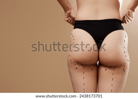 Female body with the drawing arrows. Fat lose, liposuction and cellulite removal concept. Beauty and medicine. Liposuction and plastic surgery. Overweight woman's body
