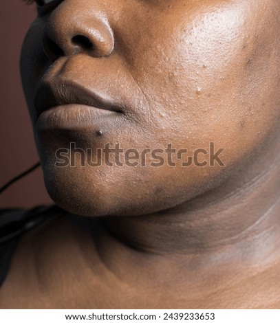 Brown skin woman with dark spots, hyperpigmentation on brown skin, african american woman with skin blemishes, imperfect skin Royalty-Free Stock Photo #2439233653