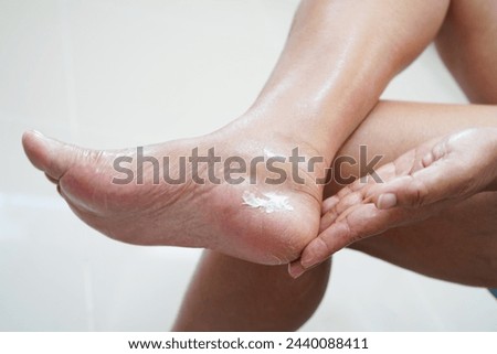 Asian woman applying moisturizing cream skincare treatment to solve and repair feet with crack and dry heel skin. Royalty-Free Stock Photo #2440088411