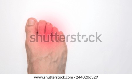 A Right foot toes of a person with a red mark representing pain Royalty-Free Stock Photo #2440206329