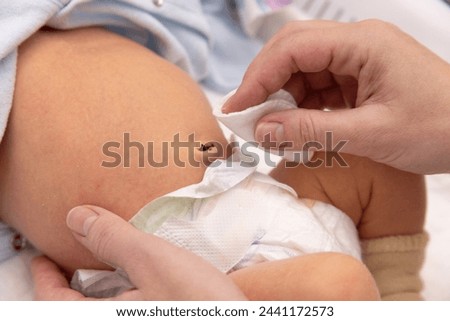 Cleaning newborn baby umbilical cord, treat the navel to a newborn baby , first week of life. Royalty-Free Stock Photo #2441172573