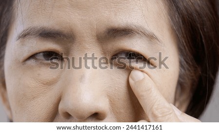 Senior asian woman worry about eye bags and dark spot. Royalty-Free Stock Photo #2441417161
