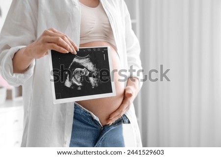 Young pregnant woman with sonogram image in children's bedroom, closeup