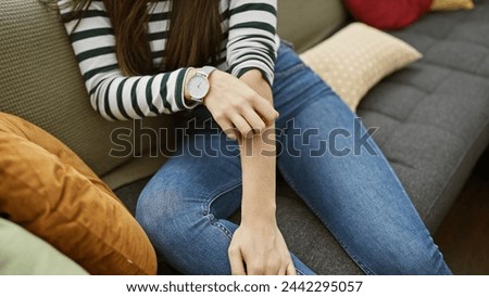 Hispanic woman scratching arm while sitting on a striped couch indoors, showing discomfort or itchiness. Royalty-Free Stock Photo #2442295057