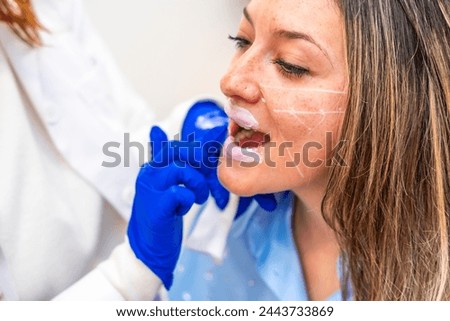 Aesthetic female doctor applying numbing cream on the lips of a patient before injecting hyaluronic acid
