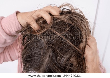 woman scratching brown hair, feeling itchy and possibly having lice, showing effects of infestation, Personal hygiene, Medical conditions, Pediculosis