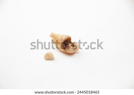 Broken teeth after surgery with isolated white background