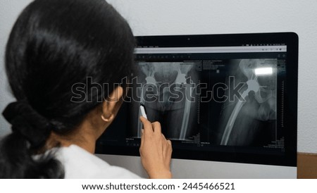 A woman is looking at a computer monitor with a picture of a leg on it. She is pointing at the leg