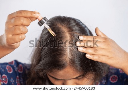 women suffering from hair loss using hair serum or minoxidil to treat alopecia