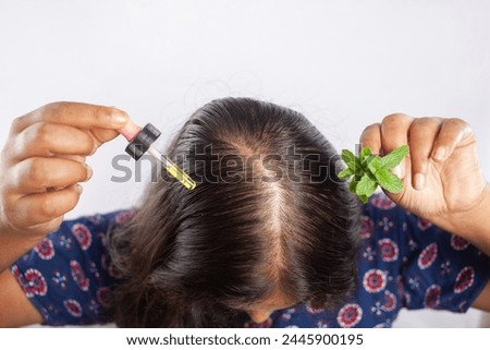 female using Peppermint herb essential oil for the treatment of female pattern baldness or alopecia