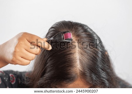 female, dermaroller, hair falling treatment, closeup, bald scalp
