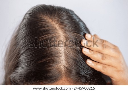women, hair fall, balding scalp, close-up, indian, white background, touching