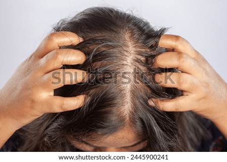 hair falling, head louse, hair care, frizzy, messy, blading scalp