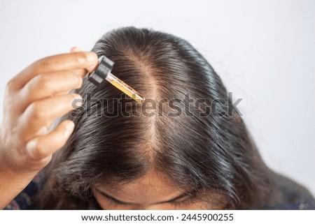 female using hair serum or minoxidil or hair oil for the treatment of hair fall or female pattern baldness