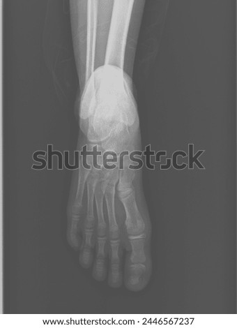 Male Normal Foot X-Ray Image 