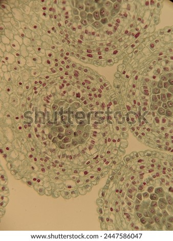 photo of section of plant tissue under the microscope