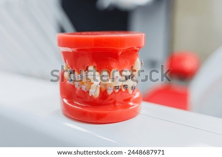 Plastic figure of a human jaw with braces. Model of human jaw with teeth