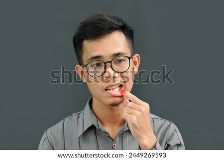 Asian man has aphthous boils on his lips. Royalty-Free Stock Photo #2449269593