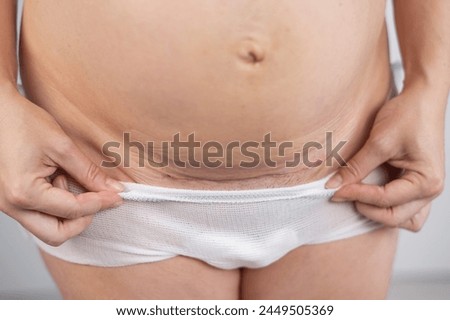 A woman shows off a fresh scar from a caesarean section.