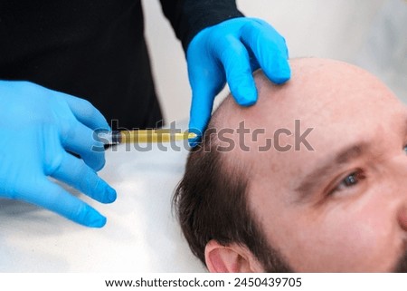 Healthcare worker performs PRP injection on patient's hairline area.